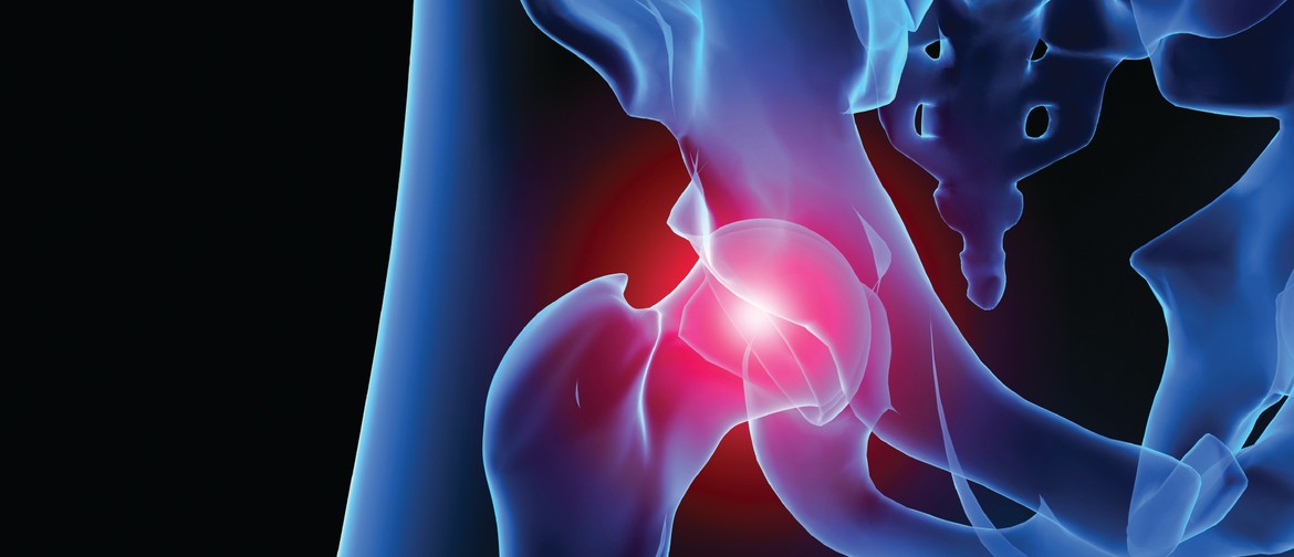Talk: Research and Joint Replacement in WA